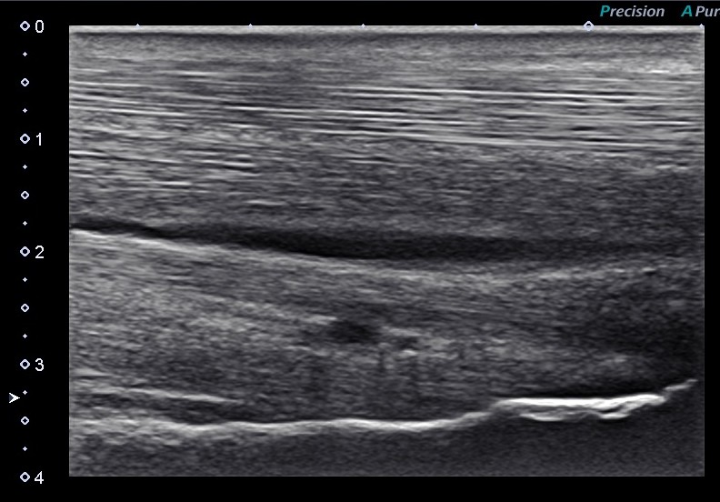 Ultrasound image of the forelimb