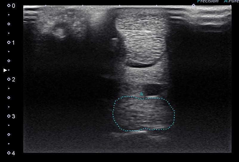 Ultrasound image of the forelimb (suspensory ligament circled)