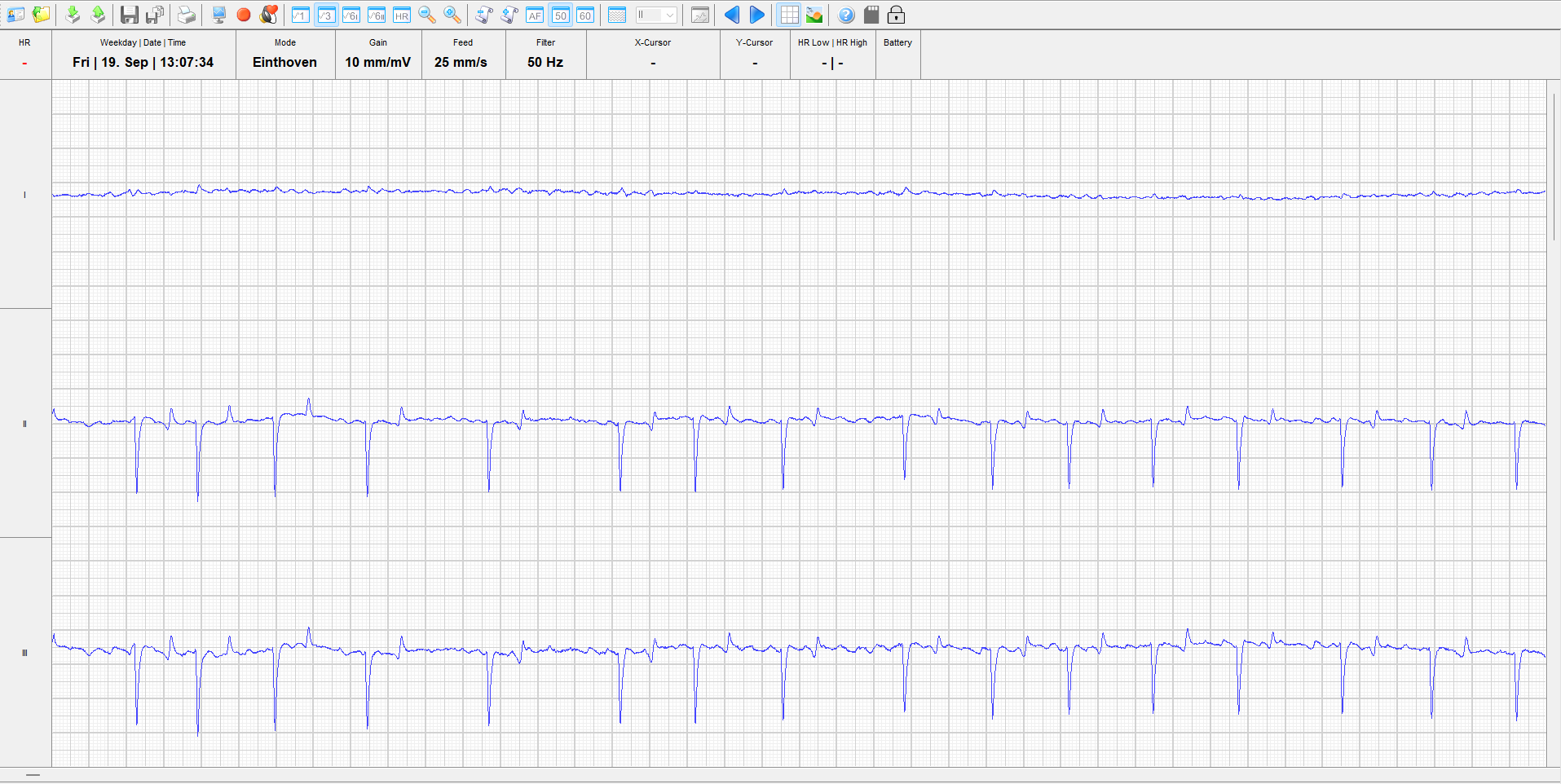 Horse in atrial fibrillation